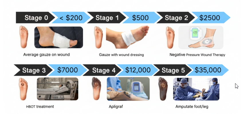 MangiCare — Nano-Encapsulated Hydrogel for Diabetic Wound Care
